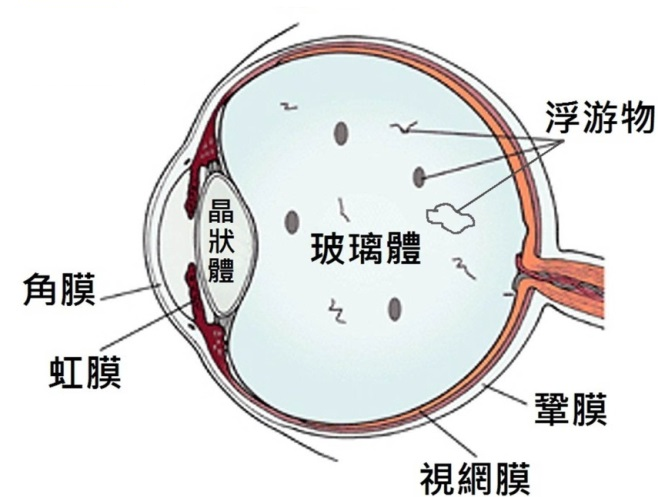 惠州眼科醫(yī)院：“蚊子”飛進眼睛里會瞎？