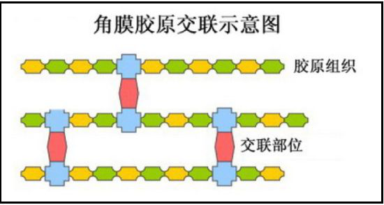 青少年近視,兒童近視,OK鏡,惠州?，斞劭漆t(yī)院